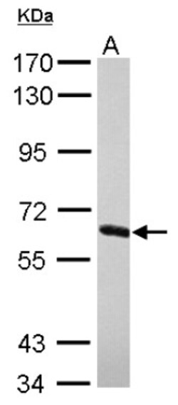 NXF2 Antibody, Novus Biologicals 0.1mL; Unlabeled:Antibodies, Polyclonal