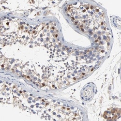 NXF3 Antibody, Novus Biologicals:Antibodies:Primary Antibodies