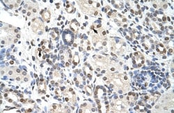NXF3 Antibody, Novus Biologicals 100&mu;L; Unlabeled:Antibodies, Polyclonal
