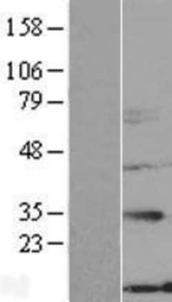 Novus Biologicals™ NXNL2 Overexpression Lysate