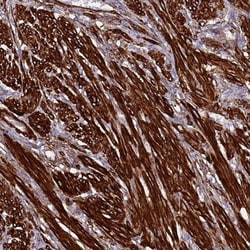 Neurexophilin-1 Antibody, Novus Biologicals 25 &mu;L | Buy Online | Novus Biologicals | Fisher Scientific