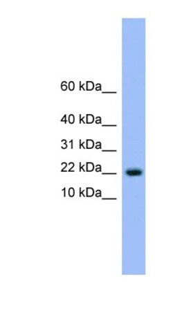 NXT1 Antibody, Novus Biologicals 100&mu;L; Unlabeled:Antibodies, Polyclonal
