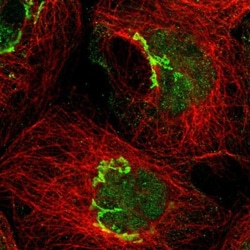 NYNRIN Antibody, Novus Biologicals 25 &mu;L; Unlabeled:Antibodies, Polyclonal