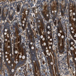NYNRIN Antibody, Novus Biologicals 25 &mu;L; Unlabeled:Antibodies, Polyclonal