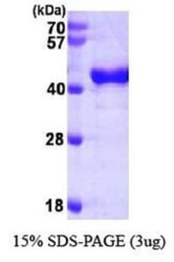 Novus Biologicals&trade;&nbsp;Recombinant Human OAS1 His Protein