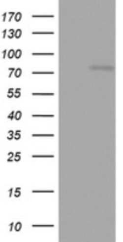 OAS2 Antibody (OTI6E6), Novus Biologicals 0.1mL; Unlabeled:Antibodies