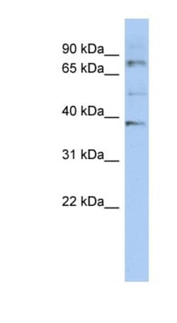 OAS2 Antibody, Novus Biologicals 0.05mg; Unlabeled:Antibodies, Polyclonal