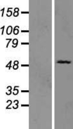 Novus Biologicals&trade;&nbsp;OAS3 Overexpression Lysate