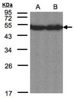 OASIS/CREB3L1 Antibody, Novus Biologicals 0.1mg; Unlabeled:Antibodies,