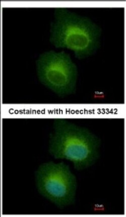 OASL Antibody, Novus Biologicals 0.1mL; Unlabeled:Antibodies, Polyclonal