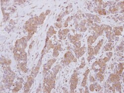 OASL Antibody, Novus Biologicals 0.1mL; Unlabeled:Antibodies, Polyclonal
