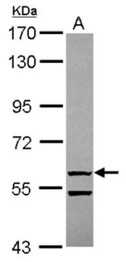 OASL Antibody, Novus Biologicals 0.1mL; Unlabeled:Antibodies, Polyclonal