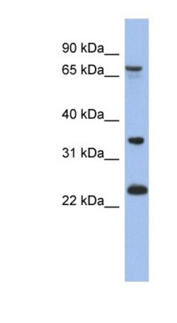 OATL1 Antibody, Novus Biologicals 100&mu;L; Unlabeled:Antibodies, Polyclonal