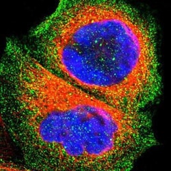 OATP1B3/SLCO1B3/OATP8 Antibody, Novus Biologicals:Antibodies:Primary Antibodies