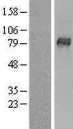 Novus Biologicals&trade;&nbsp;OATP1B3/SLCO1B3/OATP8 Overexpression Lysate