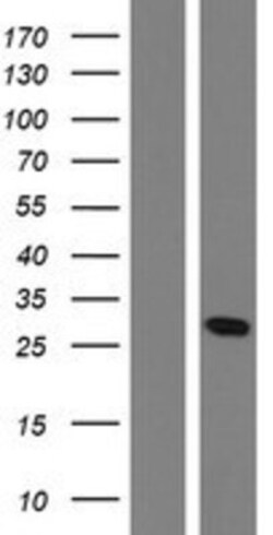 Novus Biologicals™ OAZ1 Overexpression Lysate