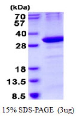 Novus Biologicals&trade;&nbsp;Recombinant Human OAZ1 His Protein