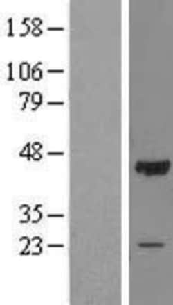 Novus Biologicals&trade;&nbsp;OBFC1 Overexpression Lysate