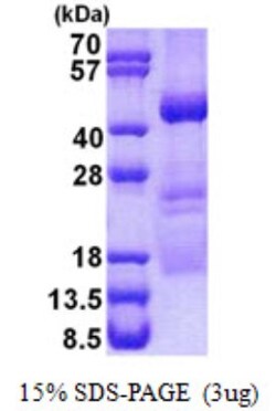 Novus Biologicals&trade;&nbsp;Recombinant Human OBFC1 His Protein
