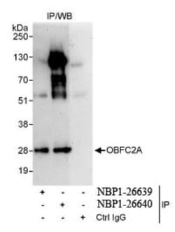 OBFC2A Antibody, Novus Biologicals 0.1mg; Unlabeled:Antibodies, Polyclonal