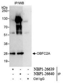 OBFC2A Antibody, Novus Biologicals 0.1mg; Unlabeled:Antibodies, Polyclonal