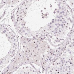 OBP2A Antibody, Novus Biologicals:Antibodies:Primary Antibodies