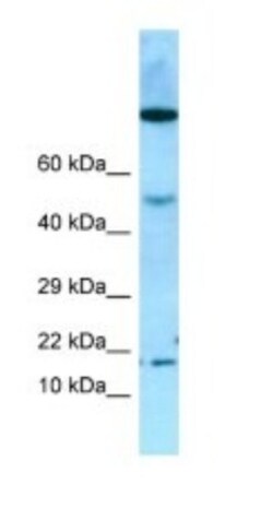 OBP2A Antibody, Novus Biologicals 100&mu;L; Unlabeled:Antibodies, Polyclonal