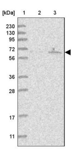 OBSL1 Antibody, Novus Biologicals 0.1mL; Unlabeled:Antibodies, Polyclonal