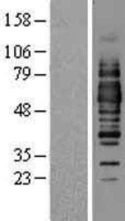 Novus Biologicals™ Occludin Overexpression Lysate