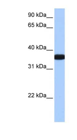 OCEL1 Antibody, Novus Biologicals 100&mu;L; Unlabeled:Antibodies, Polyclonal