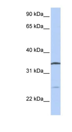 OCIAD1 Antibody, Novus Biologicals 100&mu;L; Unlabeled:Antibodies, Polyclonal
