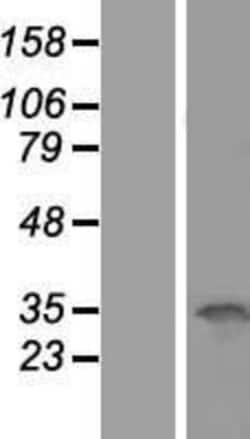 Novus Biologicals&trade;&nbsp;OCIAD1 Overexpression Lysate