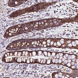OCIAD1 Antibody, Novus Biologicals 0.1mL; Unlabeled:Antibodies, Polyclonal