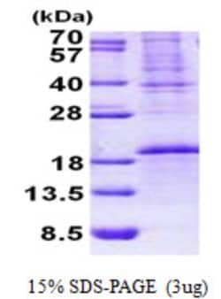 Novus Biologicals&trade;&nbsp;Recombinant Human OCIAD2 His Protein
