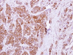 OCRL Antibody, Novus Biologicals 0.1mL; Unlabeled:Antibodies, Polyclonal