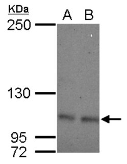 OCRL Antibody, Novus Biologicals 0.1mL; Unlabeled:Antibodies, Polyclonal