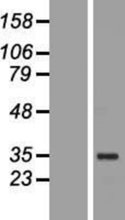 Novus Biologicals&trade;&nbsp;OCT4 Overexpression Lysate