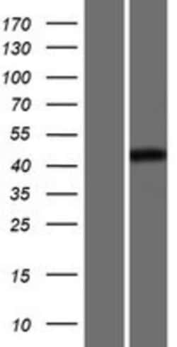 Novus Biologicals&trade;&nbsp;OCT6 Overexpression Lysate