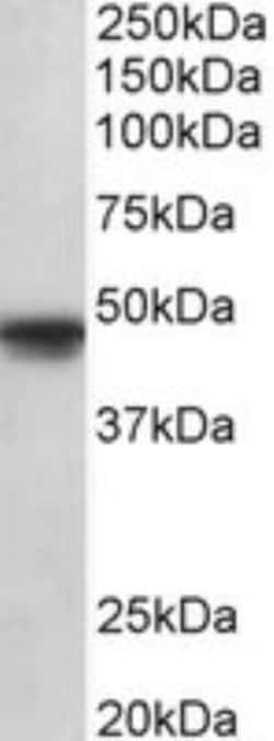 OCT6 Antibody, Novus Biologicals 0.1mg; Unlabeled:Antikroppar