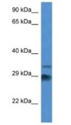 Odf1 Antibody, Novus Biologicals:Antibodies:Primary Antibodies