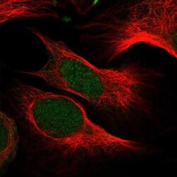 ODF3 Antibody, Novus Biologicals 25 &mu;L; Unlabeled:Antibodies, Polyclonal