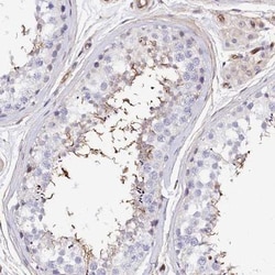 ODF3 Antibody, Novus Biologicals 25 &mu;L; Unlabeled:Antibodies, Polyclonal