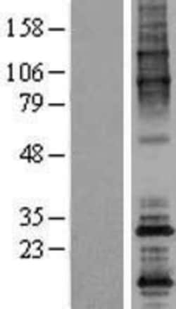 Novus Biologicals&trade;&nbsp;ODF4 Overexpression Lysate