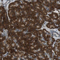 ODR4/TTG1 Antibody, Novus Biologicals:Antibodies:Primary Antibodies
