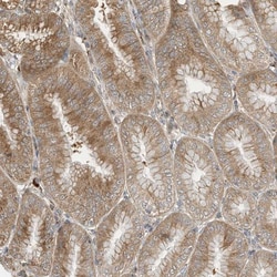 OFD1 Antibody, Novus Biologicals 0.1mL; Unlabeled:Antibodies, Polyclonal