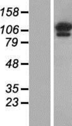 Novus Biologicals&trade;&nbsp;OGDH Overexpression Lysate