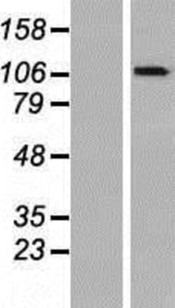 Novus Biologicals™ OGDHL Overexpression Lysate