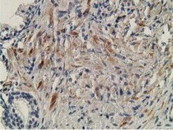 OGFOD1 Antibody (OTI1D9), Novus Biologicals 0.1mL; Unlabeled:Antibodies,