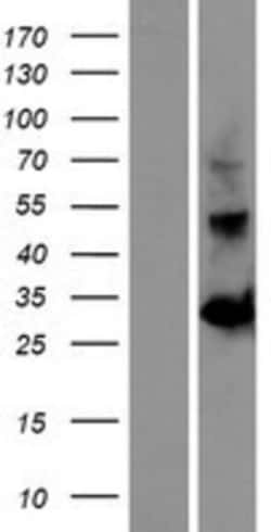 Novus Biologicals™ OGFOD2 Overexpression Lysate