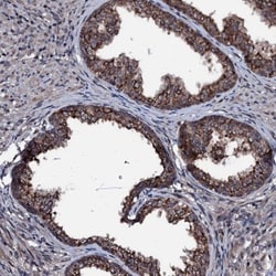 OGFOD2 Antibody, Novus Biologicals:Antibodies:Primary Antibodies